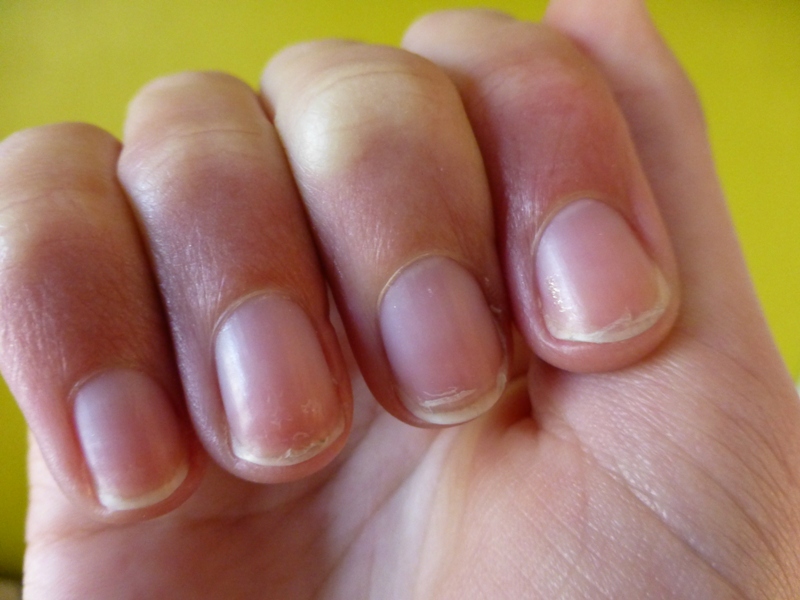 gespleten nagels vitamine